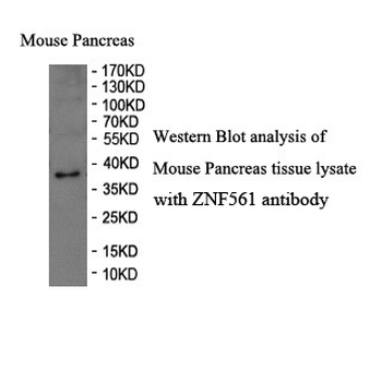 ZNF561 Rabbit Polyclonal Antibody