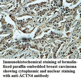 ACTN4 Rabbit Polyclonal Antibody