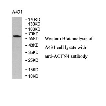 ACTN4 Rabbit Polyclonal Antibody