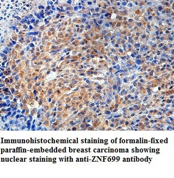 ZNF699 Rabbit Polyclonal Antibody