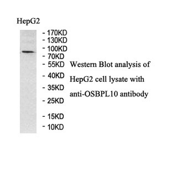 OSBPL10 Rabbit Polyclonal Antibody