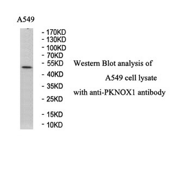 PKNOX1 Rabbit Polyclonal Antibody