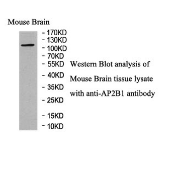AP2B1 Rabbit Polyclonal Antibody