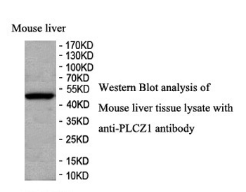 PLCZ1 Rabbit Polyclonal Antibody
