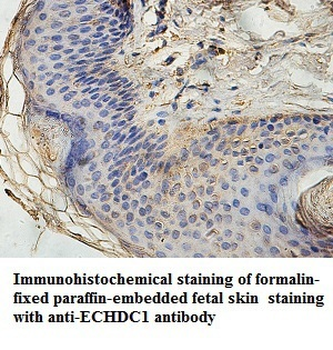 ECHDC1 Rabbit Polyclonal Antibody