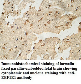 EEF1E1 Rabbit Polyclonal Antibody