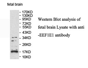 EEF1E1 Rabbit Polyclonal Antibody