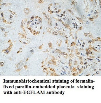 EID3 Rabbit Polyclonal Antibody