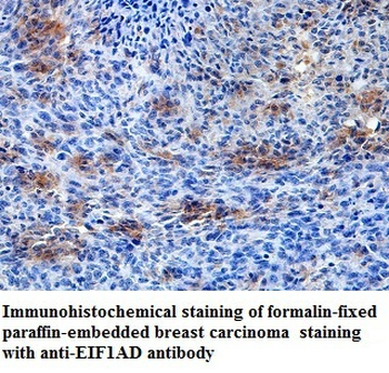 EIF1AD Rabbit Polyclonal Antibody