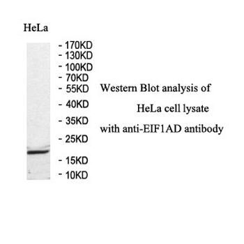 EIF1AD Rabbit Polyclonal Antibody