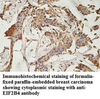 EIF2B4 Rabbit Polyclonal Antibody