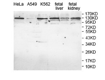 AP4E1 Rabbit Polyclonal Antibody
