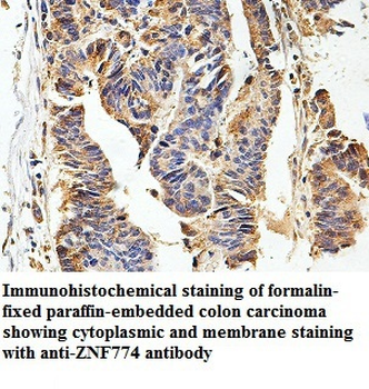 ZNF774 Rabbit Polyclonal Antibody