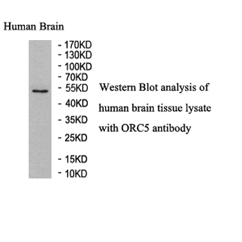 ORC5L Rabbit Polyclonal Antibody