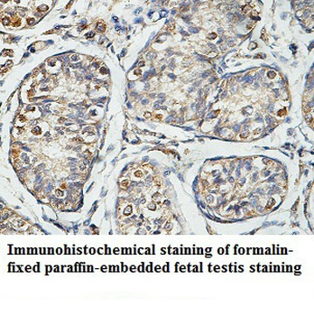 KIAA0802 Rabbit Polyclonal Antibody