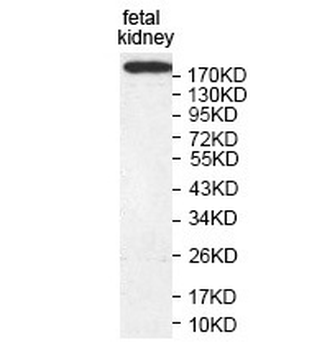 KIAA0802 Rabbit Polyclonal Antibody