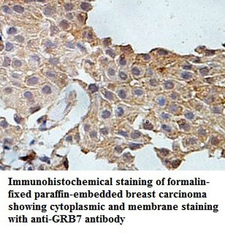 GRB7 Rabbit Polyclonal Antibody