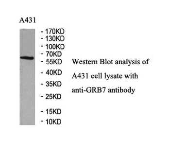 GRB7 Rabbit Polyclonal Antibody