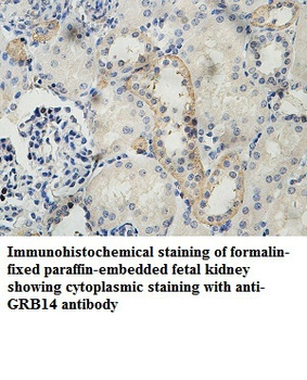 GRB14 Rabbit Polyclonal Antibody