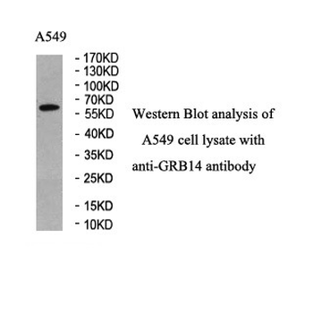 GRB14 Rabbit Polyclonal Antibody