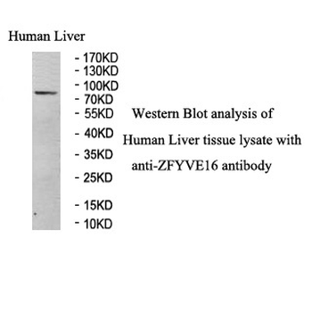 ZFYVE16 Rabbit Polyclonal Antibody