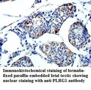 PLRG1 Rabbit Polyclonal Antibody