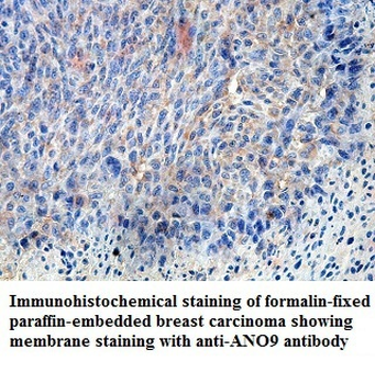 ANO9 Rabbit Polyclonal Antibody