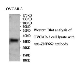 ZNF662 Rabbit Polyclonal Antibody
