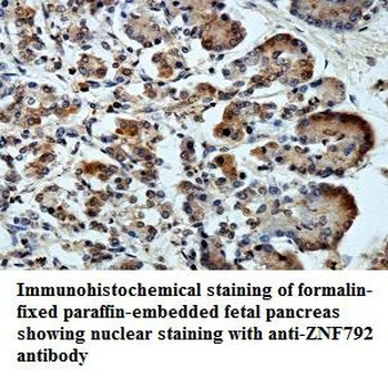 ZNF792 Rabbit Polyclonal Antibody