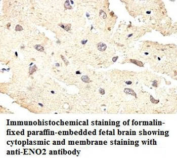 ENO2 Rabbit Polyclonal Antibody