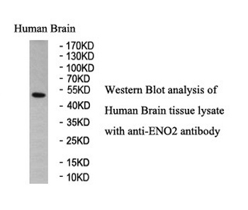 ENO2 Rabbit Polyclonal Antibody