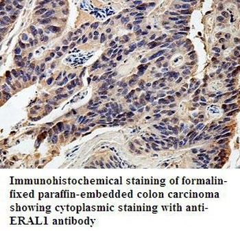 ERAL1 Rabbit Polyclonal Antibody