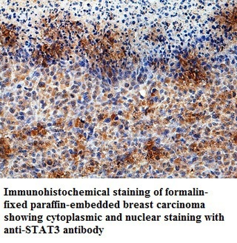 STAT3 Rabbit Polyclonal Antibody