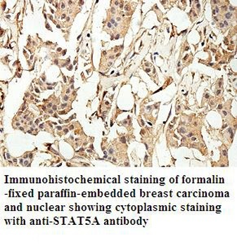 STAT5A Rabbit Polyclonal Antibody