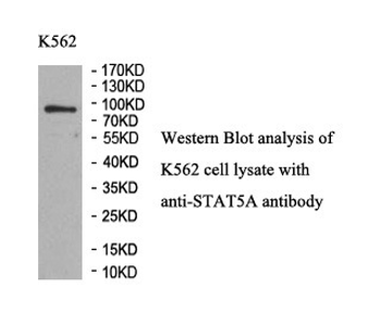 STAT5A Rabbit Polyclonal Antibody