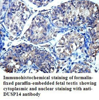 DUSP14 Rabbit Polyclonal Antibody