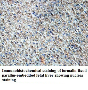 ZNF643 Rabbit Polyclonal Antibody