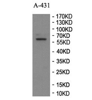 ZNF643 Rabbit Polyclonal Antibody