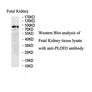 PLOD3 Rabbit Polyclonal Antibody