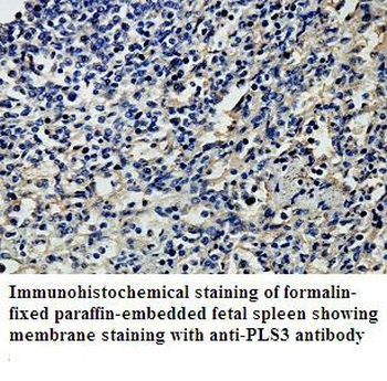 PLS3 Rabbit Polyclonal Antibody
