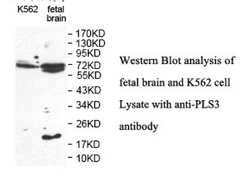 PLS3 Rabbit Polyclonal Antibody