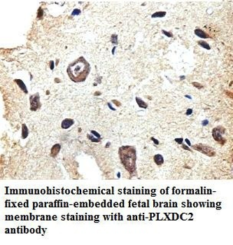 PLXDC2 Rabbit Polyclonal Antibody