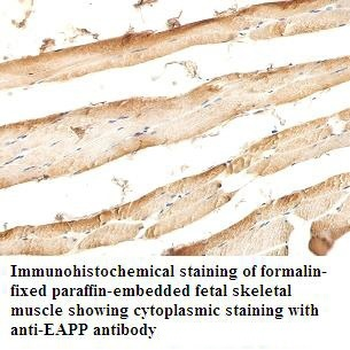 EAPP Rabbit Polyclonal Antibody