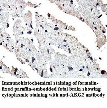 ARG2 Rabbit Polyclonal Antibody