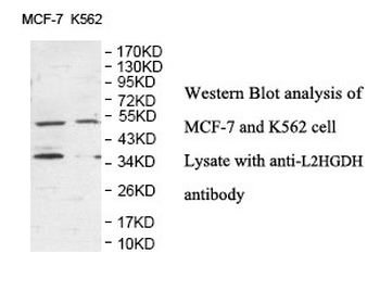 L2HGDH Rabbit Polyclonal Antibody