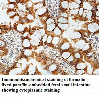 LACE1 Rabbit Polyclonal Antibody