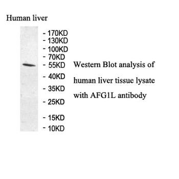 LACE1 Rabbit Polyclonal Antibody