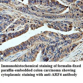 ARF4 Rabbit Polyclonal Antibody