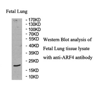ARF4 Rabbit Polyclonal Antibody