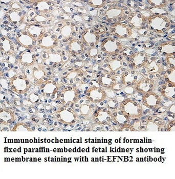 EFNB2 Rabbit Polyclonal Antibody